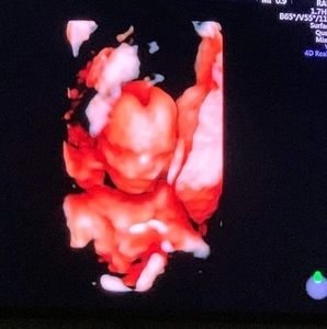 Meet your Posher, Todd